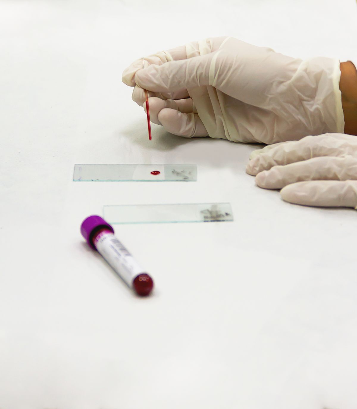 Mãos com luva segurando um tubo de coleta e lâminas de sangue sobre bancada de laboratório